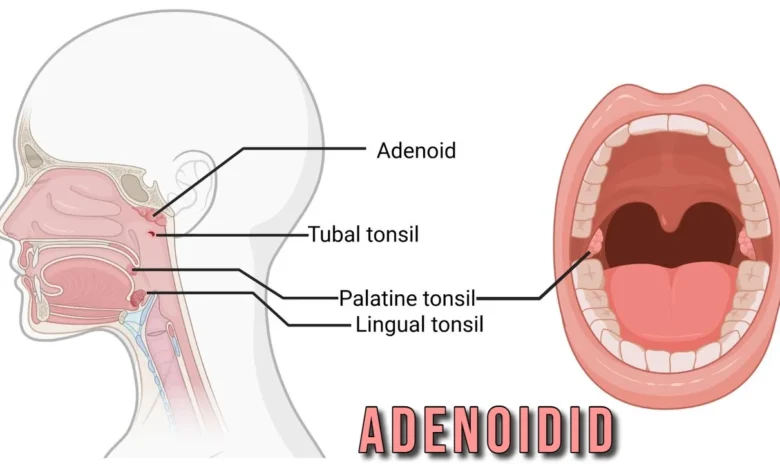 adenoidid