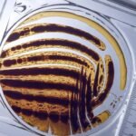 immunelektrophorese